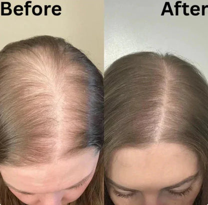 Rosemary Growth Shampoo